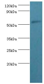 PSEN1 / Presenilin 1 Antibody - Western blot. All lanes: Presenilin-1 antibody at 2 ug/ml+HeLa whole cell lysate. Secondary antibody: Goat polyclonal to rabbit at 1:10000 dilution. Predicted band size: 53 kDa. Observed band size: 53 kDa.