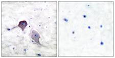 PSEN1 / Presenilin 1 Antibody - Immunohistochemistry analysis of paraffin-embedded human brain tissue, using Presenilin 1 Antibody. The picture on the right is blocked with the synthesized peptide.