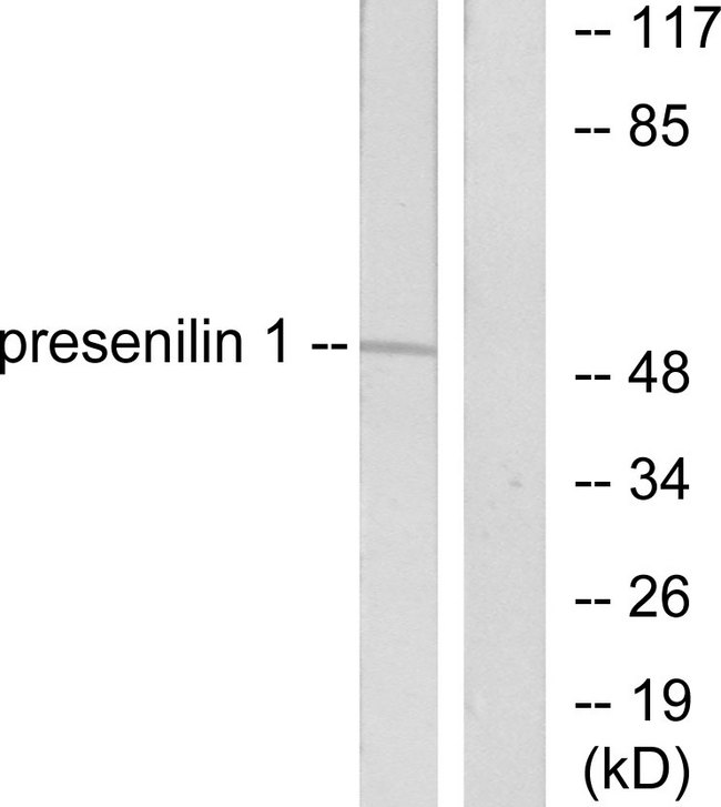 PSEN1 / Presenilin 1 Antibody - Western blot analysis of lysates from mouse heart cells, using Presenilin 1 Antibody. The lane on the right is blocked with the synthesized peptide.