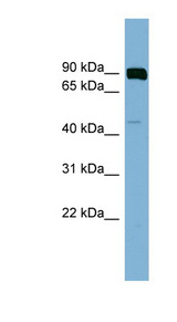 PSEN1 / Presenilin 1 Antibody - PSEN1 / Presenilin 1 antibody Western blot of OVCAR-3 cell lysate. This image was taken for the unconjugated form of this product. Other forms have not been tested.