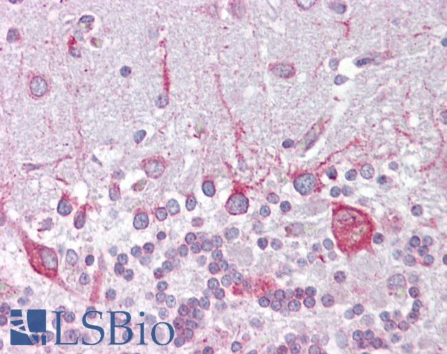 PSEN1 / Presenilin 1 Antibody - Anti-PSEN1 / Presenilin 1 antibody IHC of human brain, cerebellum. Immunohistochemistry of formalin-fixed, paraffin-embedded tissue after heat-induced antigen retrieval. Antibody concentration 5 ug/ml.  This image was taken for the unconjugated form of this product. Other forms have not been tested.