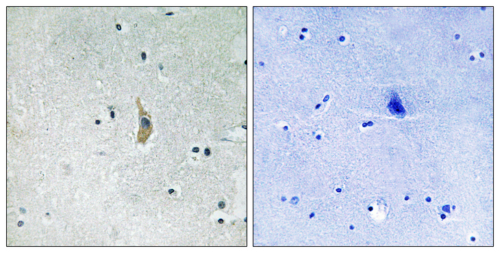 PSEN1 / Presenilin 1 Antibody - Immunohistochemistry analysis of paraffin-embedded human brain tissue, using PSEN1 Antibody. The picture on the right is blocked with the synthesized peptide.