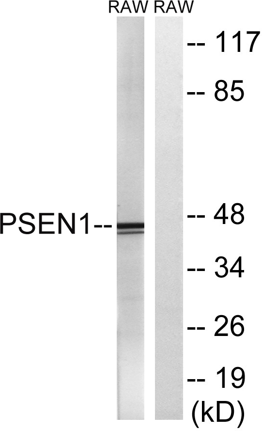 PSEN1 / Presenilin 1 Antibody - Western blot analysis of lysates from Raw264.7 cells, treated with UV 5', using PSEN1 Antibody. The lane on the right is blocked with the synthesized peptide.