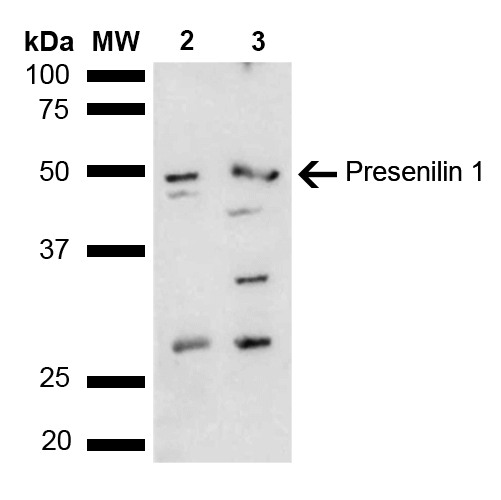 PSEN1 / Presenilin 1 Antibody - Western blot analysis of Mouse, Rat liver lysate showing detection of ~52.7 kDa Presenilin 1 protein using Rabbit Anti-Presenilin 1 Polyclonal Antibody. Lane 1: Molecular Weight Ladder (MW). Lane 2: Mouse liver lysate. Lane 3: Rat liver lysate. Load: 15 µg. Block: 5% Skim Milk in 1X TBST. Primary Antibody: Rabbit Anti-Presenilin 1 Polyclonal Antibody  at 1:1000 for 2 hours at RT. Secondary Antibody: Goat Anti-Rabbit HRP:IgG at 1:4000 for 1 hour at RT. Color Development: ECL solution for 5 min at RT. Predicted/Observed Size: ~52.7 kDa. Other Band(s): 28, 32, 42 kDa other isoforms.