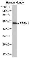 PSEN1 / Presenilin 1 Antibody - Western blot of extracts of human kidney cell lines, using PSEN1 antibody.