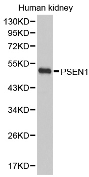 PSEN1 / Presenilin 1 Antibody - Western blot analysis of extracts of human kidney cell lines.