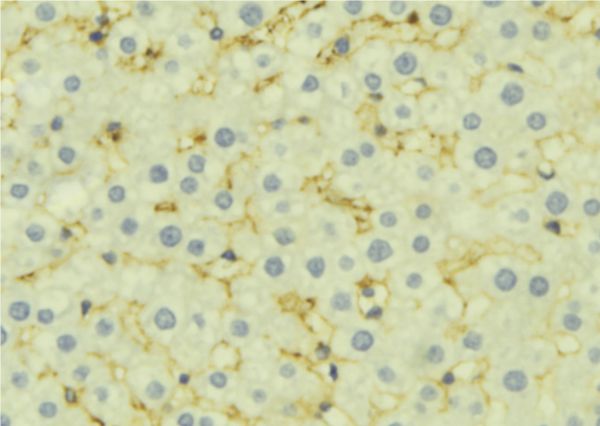 PSEN1 / Presenilin 1 Antibody - 1:100 staining mouse liver tissue by IHC-P. The sample was formaldehyde fixed and a heat mediated antigen retrieval step in citrate buffer was performed. The sample was then blocked and incubated with the antibody for 1.5 hours at 22°C. An HRP conjugated goat anti-rabbit antibody was used as the secondary.