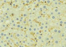 PSEN1 / Presenilin 1 Antibody - 1:100 staining mouse liver tissue by IHC-P. The sample was formaldehyde fixed and a heat mediated antigen retrieval step in citrate buffer was performed. The sample was then blocked and incubated with the antibody for 1.5 hours at 22°C. An HRP conjugated goat anti-rabbit antibody was used as the secondary.