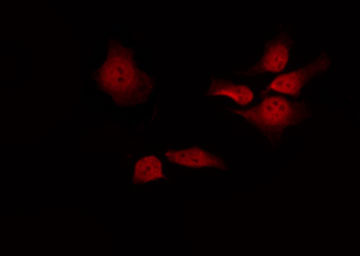 PSEN1 / Presenilin 1 Antibody - Staining RAW264.7 cells by IF/ICC. The samples were fixed with PFA and permeabilized in 0.1% Triton X-100, then blocked in 10% serum for 45 min at 25°C. The primary antibody was diluted at 1:200 and incubated with the sample for 1 hour at 37°C. An Alexa Fluor 594 conjugated goat anti-rabbit IgG (H+L) Ab, diluted at 1/600, was used as the secondary antibody.