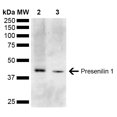 PSEN1 / Presenilin 1 Antibody - Western blot analysis of Mouse Kidney, Liver showing detection of ~52.7 kDa Presenilin 1 protein using Rabbit Anti-Presenilin 1 Polyclonal Antibody. Lane 1: Molecular Weight Ladder (MW). Lane 2: Mouse Liver. Lane 3: Mouse Kidney. Load: 15 µg. Block: 5% Skim Milk in 1X TBST. Primary Antibody: Rabbit Anti-Presenilin 1 Polyclonal Antibody  at 1:1000 for 2 hours at RT. Secondary Antibody: Goat Anti-Rabbit IgG: HRP at 1:5000 for 1 hour at RT. Color Development: ECL solution for 5 min at RT. Predicted/Observed Size: ~52.7 kDa. Other Band(s): 42.7 kDa band is isoform 5.