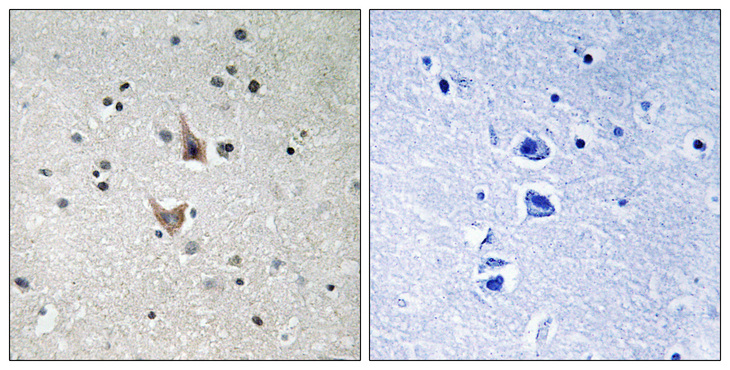 PSEN1 / Presenilin 1 Antibody - Immunohistochemistry analysis of paraffin-embedded human brain, using PSEN1 (Phospho-Ser357) Antibody. The picture on the right is blocked with the phospho peptide.