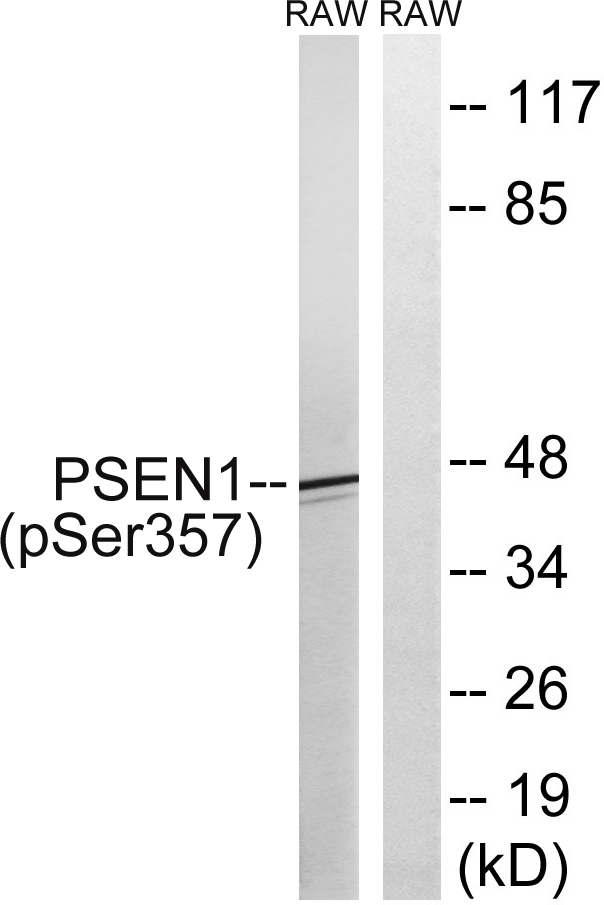 PSEN1 / Presenilin 1 Antibody - Western blot analysis of lysates from RAW264.7 cells treated with UV 5', using PSEN1 (Phospho-Ser357) Antibody. The lane on the right is blocked with the phospho peptide.