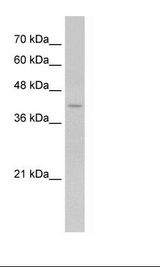 PSEN2 / Presenilin 2 Antibody - Jurkat Cell Lysate.  This image was taken for the unconjugated form of this product. Other forms have not been tested.