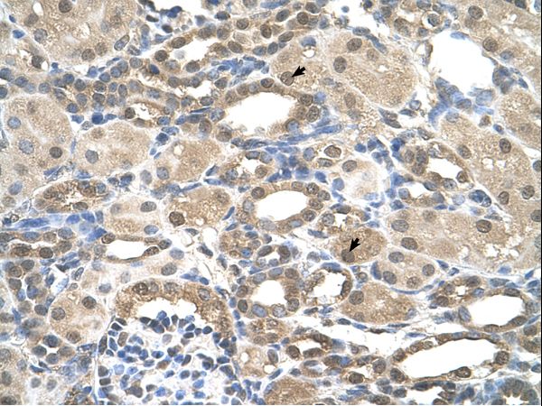 PSEN2 / Presenilin 2 Antibody - PSEN2 / Presenilin 2 antibody ARP44289_P050-NP_000438-PSEN2(presenilin 2 (Alzheimer disease 4)) Antibody was used in IHC to stain formalin-fixed, paraffin-embedded human kidney.  This image was taken for the unconjugated form of this product. Other forms have not been tested.
