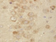 PSEN2 / Presenilin 2 Antibody -  This image was taken for the unconjugated form of this product. Other forms have not been tested.
