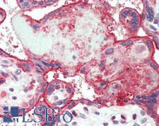 PSEN2 / Presenilin 2 Antibody - Human Placenta: Formalin-Fixed, Paraffin-Embedded (FFPE)