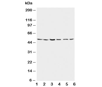 PSEN2 / Presenilin 2 Antibody - Western blot testing of Presenilin 2 antibody and Lane 1: rat brain; 2: rat brain; 3: MCF-7; 4: HeLa; 5: SMMC-7721; 6: CEM