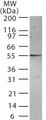 PSEN2 / Presenilin 2 Antibody - Western blot analysis for Presenilin-2 using antibody at 1:500 against 30 ug/lane of HL-60 cell lysate. A protein band of approximate molecular weight of 55 kD was detected.