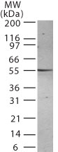 PSEN2 / Presenilin 2 Antibody - Western blot analysis for Presenilin-2 using antibody at 1:500 against 30 ug/lane of HL-60 cell lysate. A protein band of approximate molecular weight of 55 kD was detected.