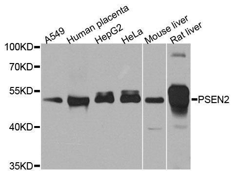 PSEN2 / Presenilin 2 Antibody - Western blot blot of extracts of various cell lines, using PSEN2 antibody.