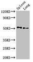 PSEN2 / Presenilin 2 Antibody - Western Blot Positive WB detected in:Rat spleen tissue,Rat lung tissue All Lanes:PSEN2 antibody at 3µg/ml Secondary Goat polyclonal to rabbit IgG at 1/50000 dilution Predicted band size: 51,47 KDa Observed band size: 51 KDa