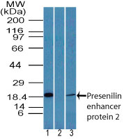 PSENEN / PEN-2 Antibody - Western blot of Presenilin enhancer protein 2 in human intestine lysate in the 1) absence and 2) presence of immunizing peptide and 3) mouse intestine lysate using Polyclonal Antibody to Presenilin enhancer protein 2 at 3 and 7 ug/ml, respectively. Goat anti-rabbit Ig HRP secondary antibody, and PicoTect ECL substrate solution, were used for this test.