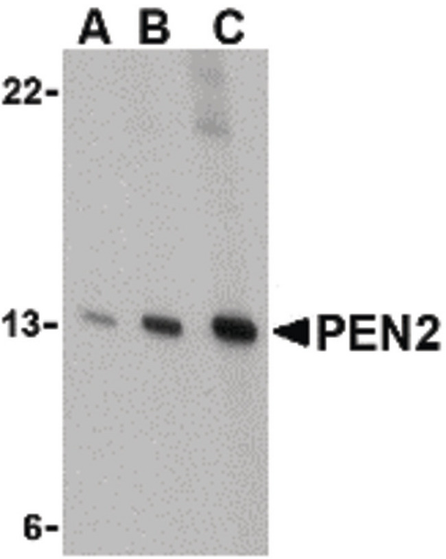 PSENEN / PEN-2 Antibody - Western blot of PEN2 in K562 cell lysate with PEN2 antibody at (A) 0.5, (B) 1, and (C) 2 ug/ml.