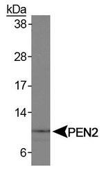 PSENEN / PEN-2 Antibody - PEN2 Antibody - Western blot analysis of PEN2 on human placenta.