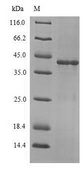 Beta-lactamase OXA-10 Protein - (Tris-Glycine gel) Discontinuous SDS-PAGE (reduced) with 5% enrichment gel and 15% separation gel.