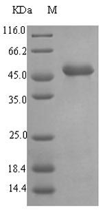 lasB Protein - (Tris-Glycine gel) Discontinuous SDS-PAGE (reduced) with 5% enrichment gel and 15% separation gel.