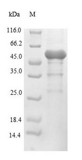 lpxC / asmB / envA Protein - (Tris-Glycine gel) Discontinuous SDS-PAGE (reduced) with 5% enrichment gel and 15% separation gel.