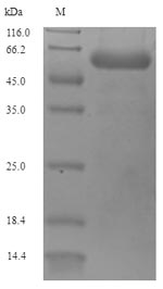 OmpD Protein - (Tris-Glycine gel) Discontinuous SDS-PAGE (reduced) with 5% enrichment gel and 15% separation gel.