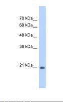 PSF1 / GINS2 Antibody - HepG2 cell lysate. Antibody concentration: 0.25 ug/ml. Gel concentration: 12%.  This image was taken for the unconjugated form of this product. Other forms have not been tested.