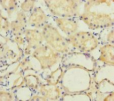 PSF1 / GINS2 Antibody - Immunohistochemistry of paraffin-embedded human kidney tissue at dilution of 1:100