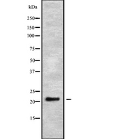 PSF1 / GINS2 Antibody - Western blot analysis GINS2 using Jurkat whole cells lysates