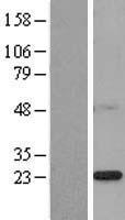 PSF1 / GINS2 Protein - Western validation with an anti-DDK antibody * L: Control HEK293 lysate R: Over-expression lysate