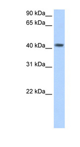 PSG / PSG5 Antibody - PSG5 antibody ARP42067_T100-NP_002772-PSG5(pregnancy specific beta-1-glycoprotein 5) Antibody Western blot of Placenta lysate.  This image was taken for the unconjugated form of this product. Other forms have not been tested.