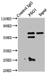 PSG1 / CD66f Antibody - Immunoprecipitating PSG1 in A549 whole cell lysate Lane 1: Rabbit control IgG instead of PSG1 Antibody in A549 whole cell lysate.For western blotting, a HRP-conjugated Protein G antibody was used as the secondary antibody (1/2000) Lane 2: PSG1 Antibody (8µg) + A549 whole cell lysate (500µg) Lane 3: A549 whole cell lysate (10µg)