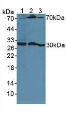 PSG1 / CD66f Antibody - Western Blot; Sample: Lane1: Human Hela Cells; Lane2: Mouse Kidney Tissue; Lane3: Mouse Breast Cancer Tissue.