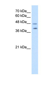 PSG1 / CD66f Antibody - PSG1 antibody ARP42326_T100-NP_008836-PSG1(pregnancy specific beta-1-glycoprotein 1) Antibody Western blot of NCI-H226 cell lysate.  This image was taken for the unconjugated form of this product. Other forms have not been tested.