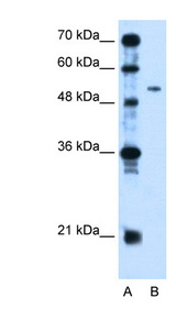 PSG1 / CD66f Antibody - PSG1 antibody ARP42325_T100-NP_008836-PSG1(pregnancy specific beta-1-glycoprotein 1) Antibody Western blot of Jurkat lysate.  This image was taken for the unconjugated form of this product. Other forms have not been tested.