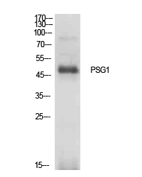 PSG1 / CD66f Antibody - Western blot analysis of extracts from 4T1 cells, using PSG1 Antibody.