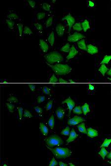 PSG1 / CD66f Antibody - Immunofluorescence analysis of U2OS cells using PSG1 antibody. Blue: DAPI for nuclear staining.