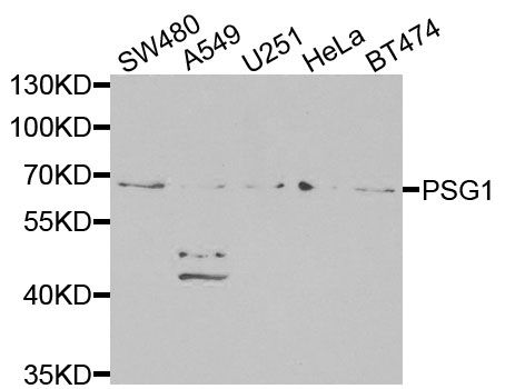 PSG1 / CD66f Antibody - Western blot analysis of extracts of various cell lines, using PSG1 antibody at 1:1000 dilution. The secondary antibody used was an HRP Goat Anti-Rabbit IgG (H+L) at 1:10000 dilution. Lysates were loaded 25ug per lane and 3% nonfat dry milk in TBST was used for blocking. An ECL Kit was used for detection and the exposure time was 90s.