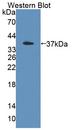 PSG2 Antibody - Western blot of PSG2 antibody.