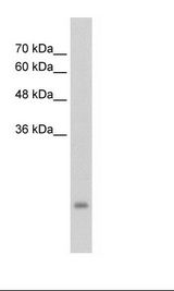 PSG3 Antibody - HepG2 Cell Lysate.  This image was taken for the unconjugated form of this product. Other forms have not been tested.