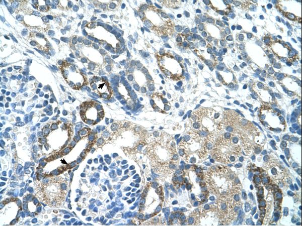 PSG3 Antibody - PSG3 antibody ARP42577_T100-AAD28498-PSG3(pregnancy specific beta-1-glycoprotein 3) Antibody was used in IHC to stain formalin-fixed, paraffin-embedded human kidney.  This image was taken for the unconjugated form of this product. Other forms have not been tested.