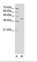 PSG6 Antibody - A: Marker, HepG2 Cell Lysate.  This image was taken for the unconjugated form of this product. Other forms have not been tested.