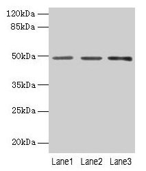 PSG6 Antibody - Western blot All lanes: PSG6 antibody at 6µg/ml Lane 1: HepG2 whole cell lysate Lane 2: 293T whole cell lysate Lane 3: Raji whole cell lysate Lane 4: MCF-7 whole cell lysate Secondary Goat polyclonal to rabbit IgG at 1/10000 dilution Predicted band size: 49, 48 kDa Observed band size: 49 kDa
