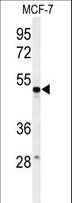 PSG7 Antibody - Western blot of PSG7 Antibody in MCF-7 cell line lysates (35 ug/lane). PSG7 (arrow) was detected using the purified antibody.